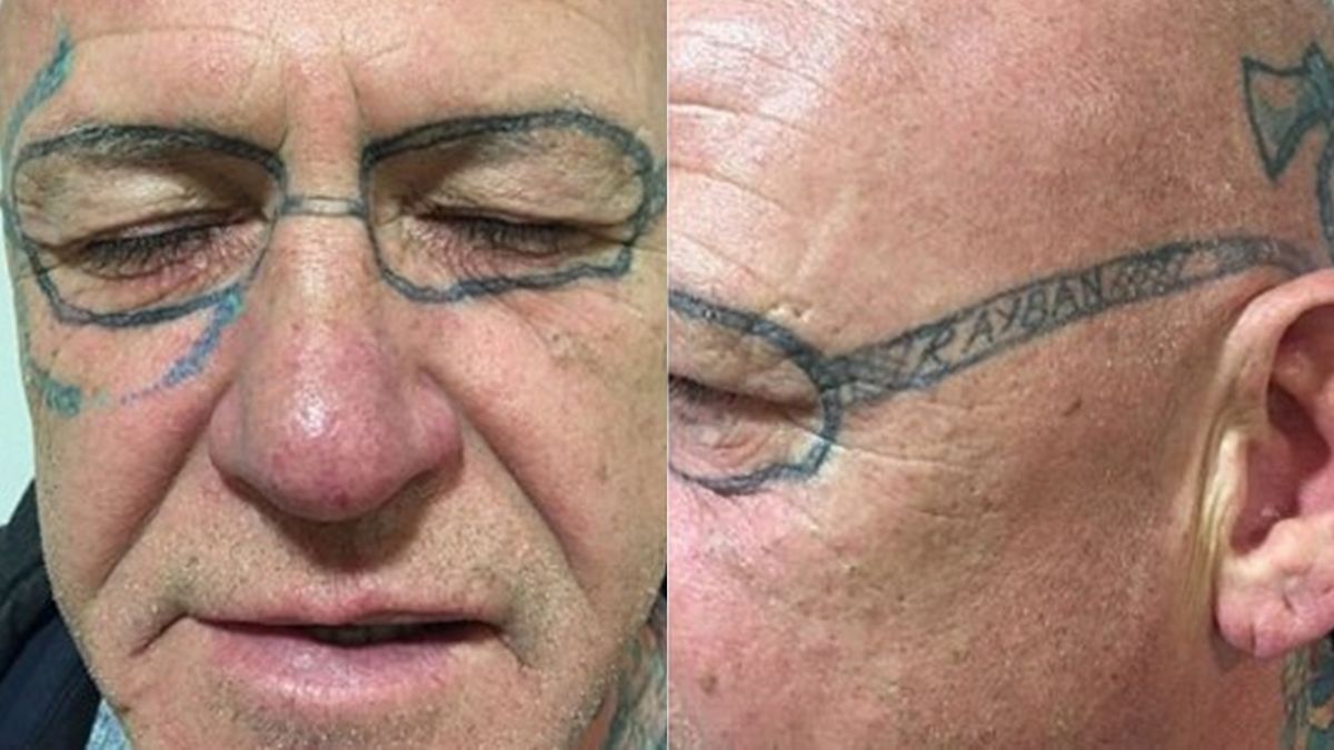 Salió tomó de más y le tatuaron la cara