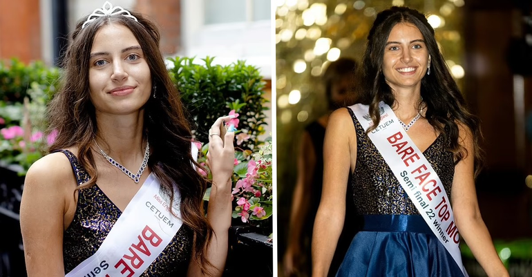 Miss Inglaterra La Primera Joven En Competir Sin Maquillaje