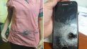 el celular le salvo la vida: para robarle le dispararon y la bala impacto en el aparato el celular le salvo la vida: para robarle le dispararon y la bala impacto en el aparato