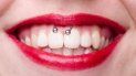 enfermedad silenciosa: especialistas alertan por los piercings en la boca enfermedad silenciosa: especialistas alertan por los piercings en la boca