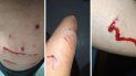harta de que la muerdan los perros de sus vecinos, los denuncio en la policia harta de que la muerdan los perros de sus vecinos, los denuncio en la policia