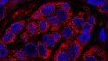 descubren el origen de la metastasis y comienzan a investigar posibles tratamientos descubren el origen de la metastasis y comienzan a investigar posibles tratamientos