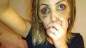 ataco brutalmente a su ex novia y amenazo con matarla ataco brutalmente a su ex novia y amenazo con matarla