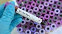 coronavirus: confirman la novena muerte en el pais coronavirus: confirman la novena muerte en el pais