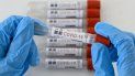 coronavirus en jujuy: registraron 88 nuevos casos coronavirus en jujuy: registraron 88 nuevos casos