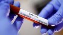 confirman 10 nuevos casos de coronavirus en jujuy confirman 10 nuevos casos de coronavirus en jujuy
