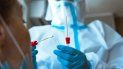 Coronavirus en Argentina Coronavirus en Argentina