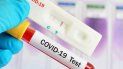 coronavirus: amplian la definicion de caso positivo en argentina coronavirus: amplian la definicion de caso positivo en argentina