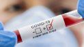 coronavirus en jujuy: confirmaron 111 nuevos casos, 3 muertes y 58 altas medicas en 24 horas coronavirus en jujuy: confirmaron 111 nuevos casos, 3 muertes y 58 altas medicas en 24 horas