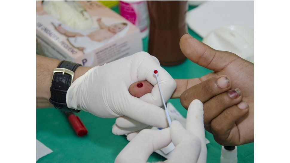 Test para diagnosticar VIH