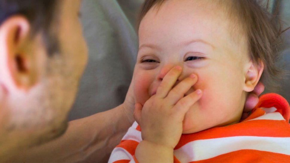 Síndrome de Down: hoy se celebra el día mundial