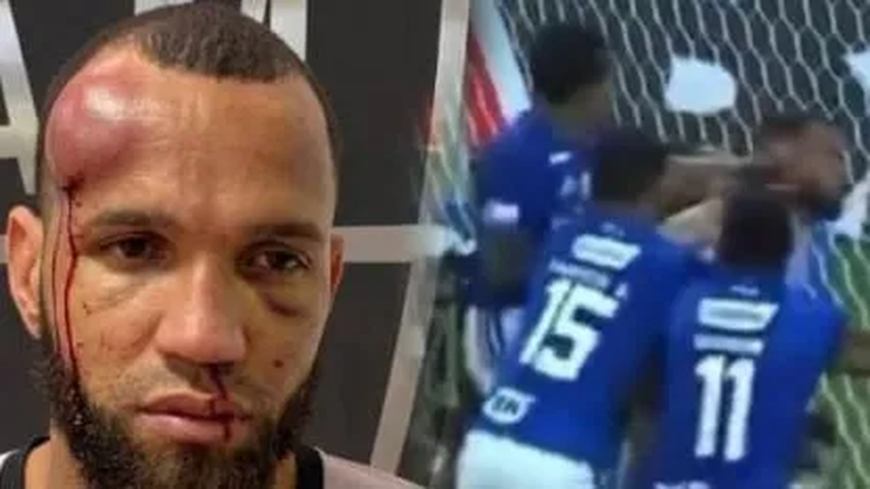 Así quedó Everson Felipe Marques Pires, arquero de Atlético Mineiro tras la batalla campal con Cruzeiro