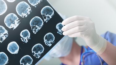 ACV - Imagen alusiva