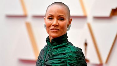 Que es la alopecia areata, la enfermedad que sufre Jada Pinkett Smith.&nbsp;