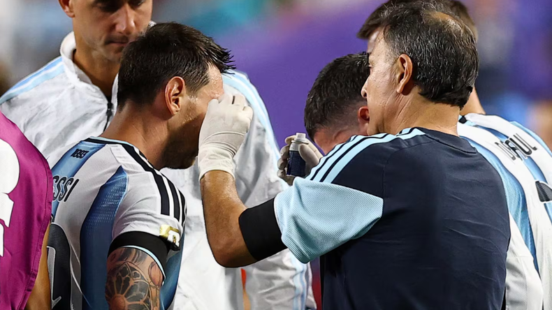 Qu&eacute; le pas&oacute; a Lionel Messi en el ojo