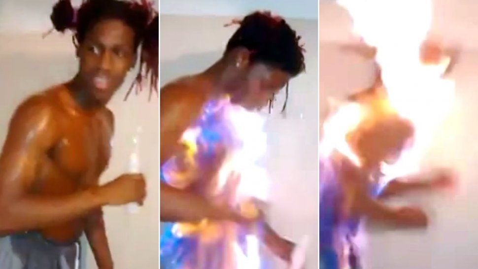 Fire Challenge, el peligroso reto viral que invade las redes y casi se cobra una vida