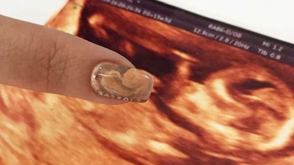 ¿Se nos fue de las manos? Una manicura ofrece la impresión de una ecografía en las uñas