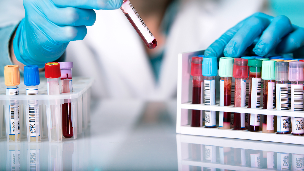 Test Elisa Test Pcr Cu L Es La Diferencia