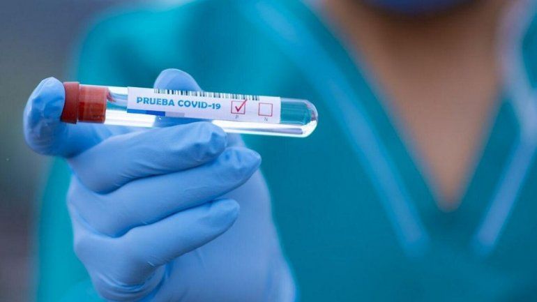 Casos de coronavirus en Jujuy