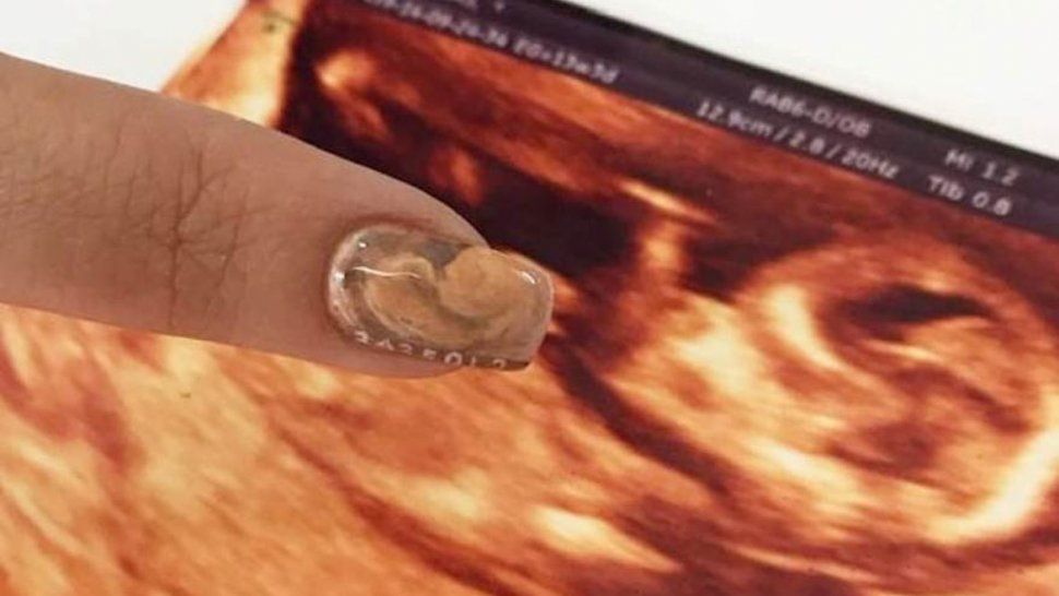 ¿Se nos fue de las manos? Una manicura ofrece la impresión de una ecografía en las uñas