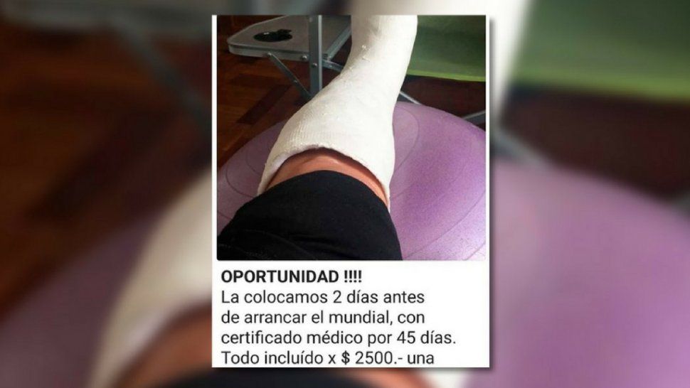 ¡Insólito! Ofrecen yeso para faltar al trabajo y ver el Mundial