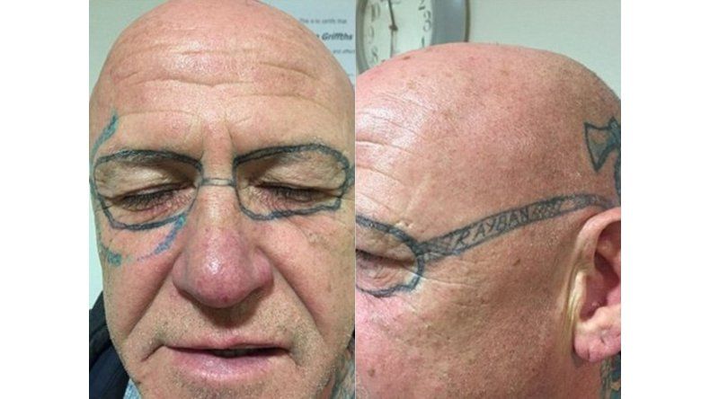 Salió, tomó de más y le tatuaron la cara