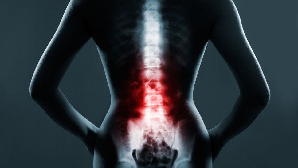 Mieloma múltiple, un cáncer que afecta a miles de personas y cada vez es más frecuente