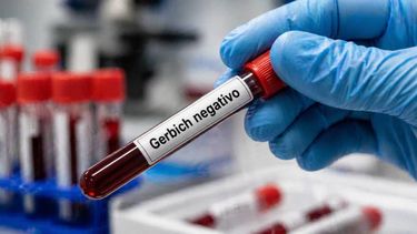 Casos de Gerbich negativo Casos de Gerbich negativo