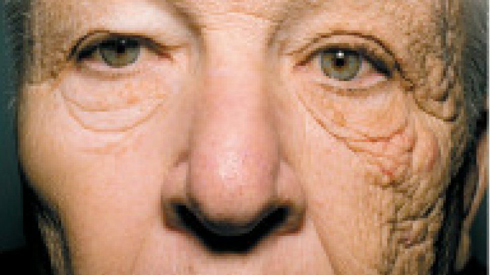 Envejeció de un solo lado: la verdad sobre el cuidado de la piel es viral