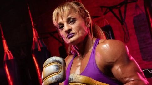 Todo Jujuy | Qué es un ACV isquémico, el cuadro de salud que padece Alejandra Locomotora Oliveras.