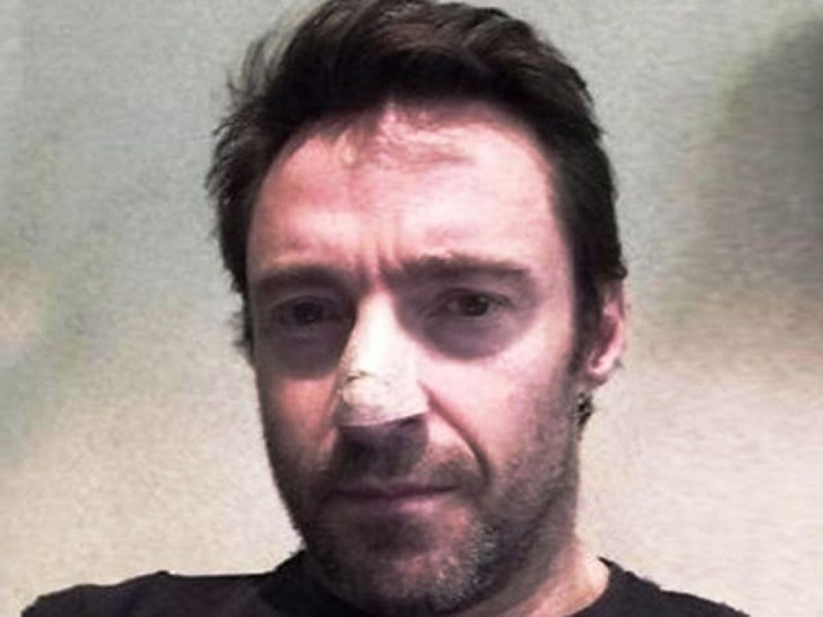Hugh Jackman