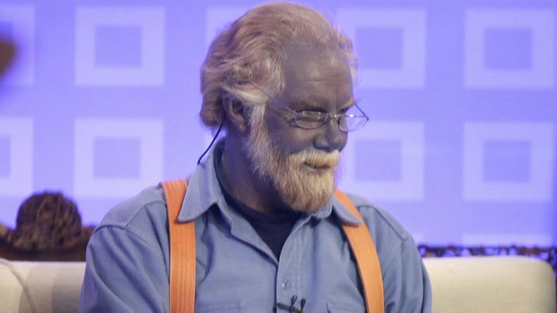 La extraña condición médica que sufrió Paul Karason, conocido como “Papá Pitufo” que tiñó todo su cuerpo de color azul.