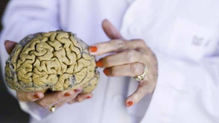 Los científicos consideran que hay que conservar un cerebro joven y en ese sentido los investigadores de Harvard recomiendan 12 consejos de actividades. 