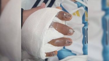 Alumnoherido en Palpalá