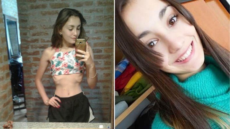 Mostró la anorexia en su cuerpo y la foto se volvió viral: decidí vivir