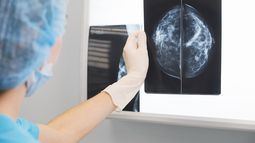 Beneficios en mamografía para afiliadas del ISJ