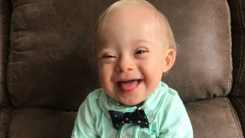 Un niño con síndrome de Down será la imagen de una marca de comida infantil por primera vez