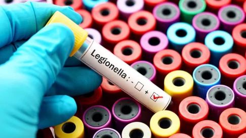 Todo Jujuy | legionella bacteria.jpg