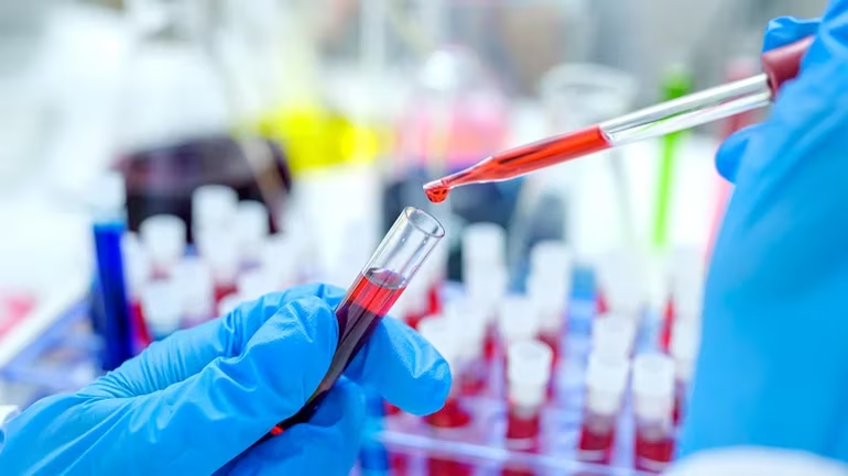 Un comunicado de la Confederación Unificada Bioquímica de la República Argentina (CUBRA) anunció que cobrarán extra a los usuarios (Getty Images)