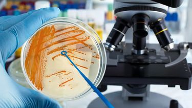 Desde finales del año pasado hay alerta por la bacteria esptreptococo en varios países de Europa.