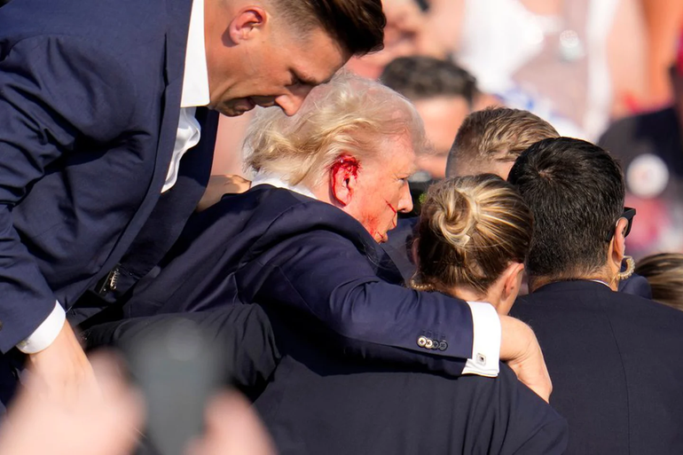 Donald Trump fue visto con sangre en su oreja derecha (X: @apex_archive) Donald Trump fue visto con sangre en su oreja derecha (X: @apex_archive)