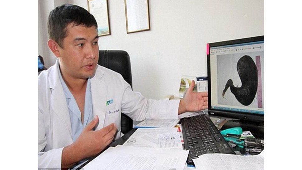 Caso sin antecedentes