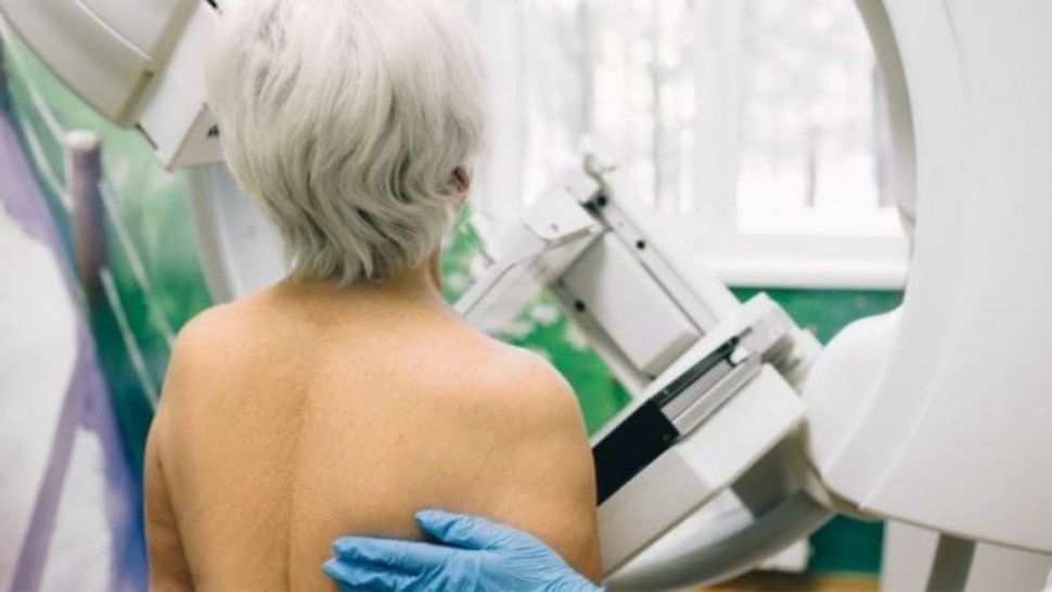 Cáncer en la pandemia: en el 2020 hay una reducción del 80% en estudios preventivos