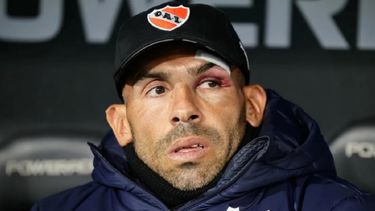 Según se informó, Carlos Tevez estaría afrontando este problema por&nbsp;un “tema de stress”.