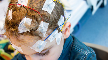 Epilepsia: síntomas, mitos y qué hacer ante una crisis