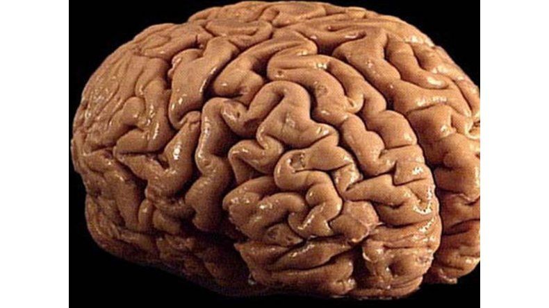 Cerebro