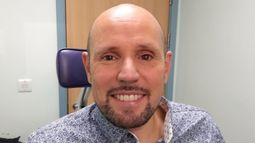 Un londinense será la primera persona en recibir un ojo impreso en 3D.&nbsp;