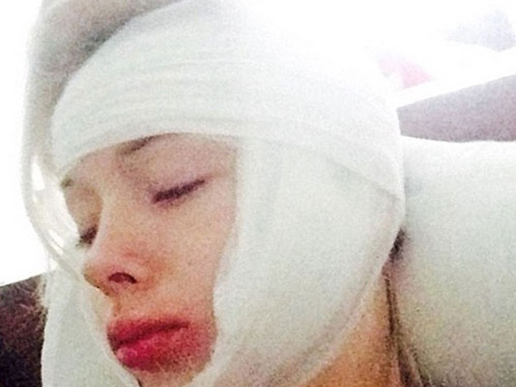 Golpean a Barbie Humana