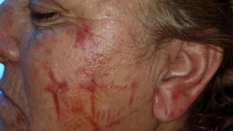 Indignante: le pateó la cara a una mujer y le dejó marcada la planta de la zapatilla