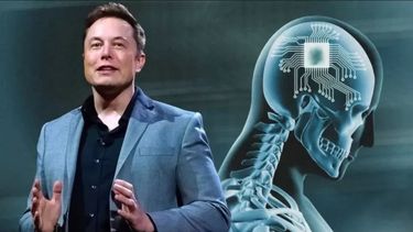 Neuralink fue autorizada a ensayar implantes cerebrales en humanos.